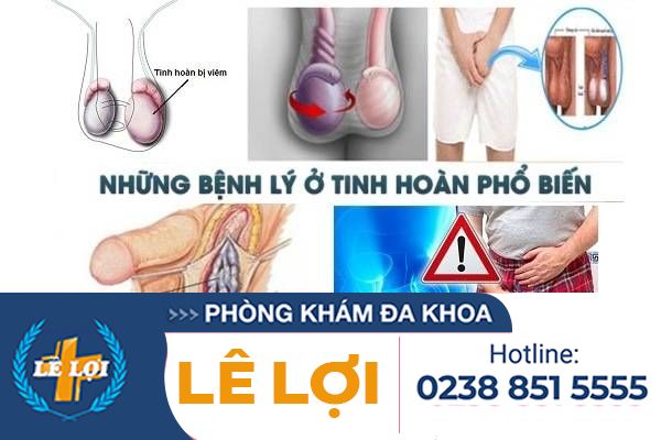 Có khối u tinh hoàn là bị bệnh gì?