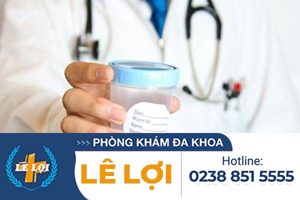 Những điều bạn cần biết về xét nghiệm tinh dịch đồ