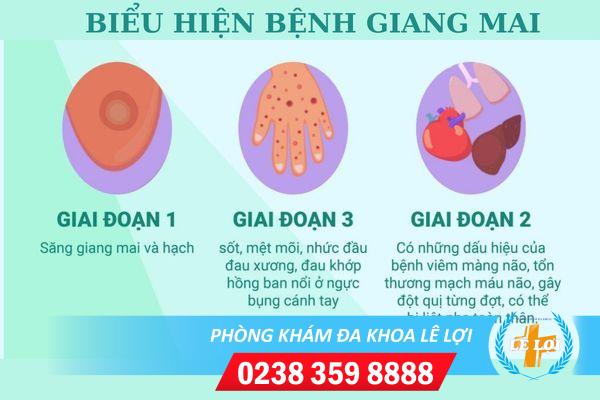 Cách điều trị bệnh giang mai