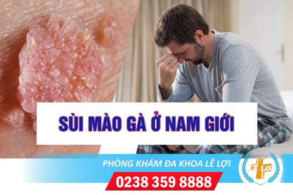 Sùi mào gà vùng kín nam dấu hiệu và cách chữa trị