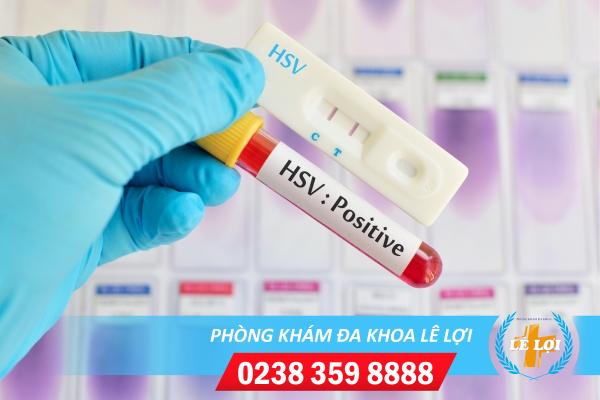 Hỗ trợ điều trị mụn rộp sinh dục bằng những phương pháp nào?