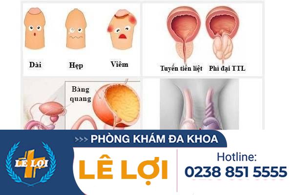 Phòng tránh các bệnh nam khoa thường gặp ở nam giới