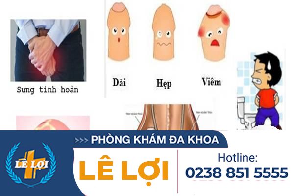 bieu-hien-benh-nam-khoa-nguy-hiem