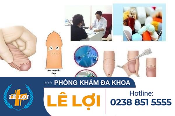 Những cách hỗ trợ chữa hẹp bao quy đầu hiệu quả cho nam giới