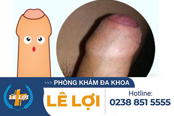 hinh-anh-hep-bao-quy-dau