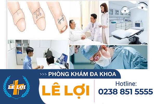 Thủ thuật cắt bao quy đầu không đau tại Đa Khoa Lê Lợi
