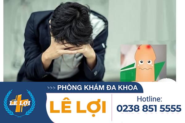 sung-do-bao-quy-dau-ly-do