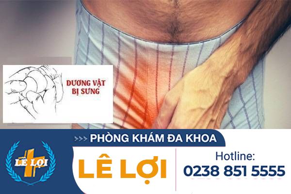 Bạn có biết bị sưng dương vật là bệnh gì và phương pháp xử lý