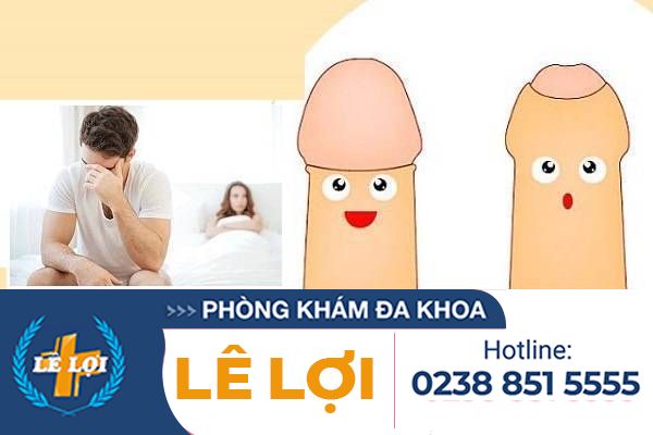 Những tác hại của dài bao quy đầu ở nam giới?