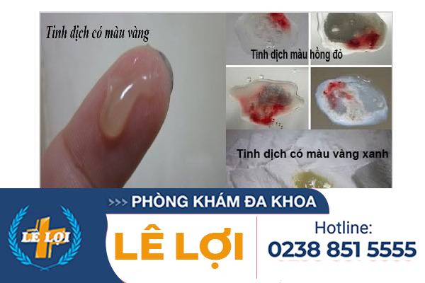 Bạn cần phải cẩn thận khi tinh dịch có màu sắc khác thường
