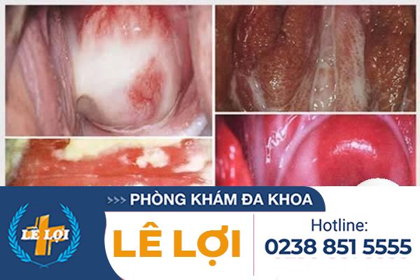 viem-am-dao-o-nu-bieu-hien