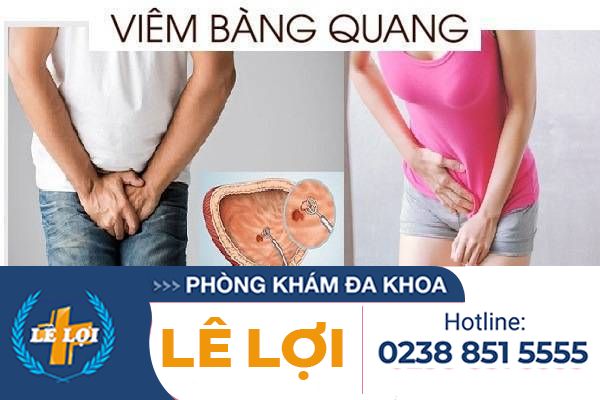 Bệnh viêm bàng quang và những kiến thức cần biết