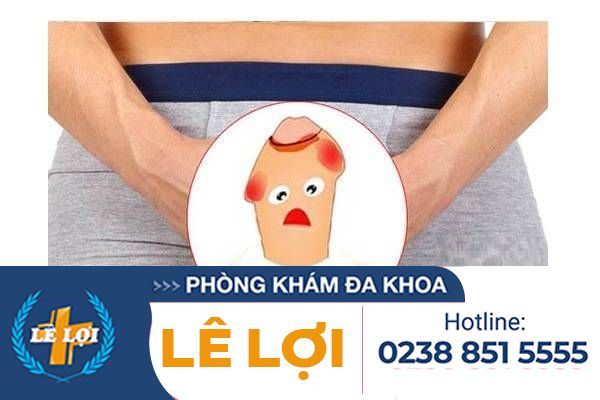 Viêm dương vật – Một trong những triệu chứng nam khoa đáng sợ