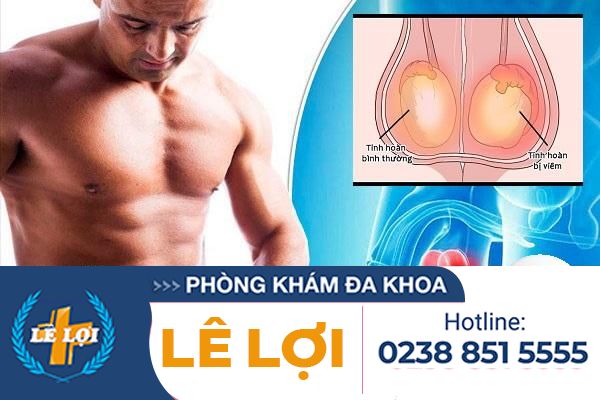Viêm tinh hoàn – căn bệnh gây hại với sức khỏe sinh sản