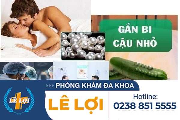 Phương pháp gắn bi dương vật tiên tiến tại Phòng khám Lê Lợi