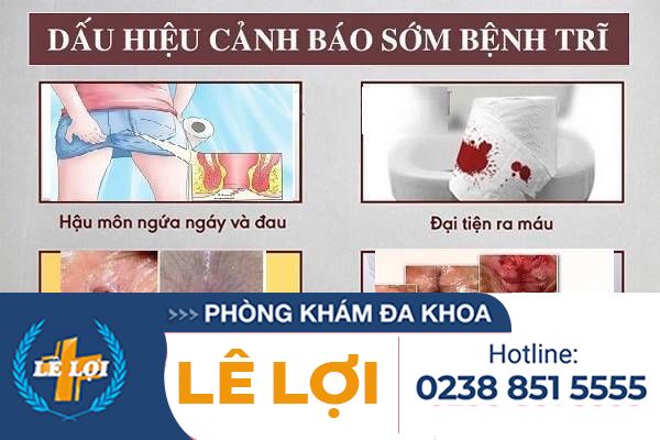 dau-hieu-benh-tri-dien-hinh