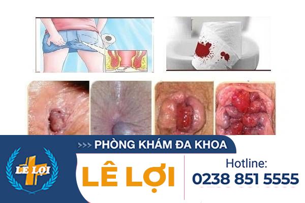 tac-hai-cua-benh-tri