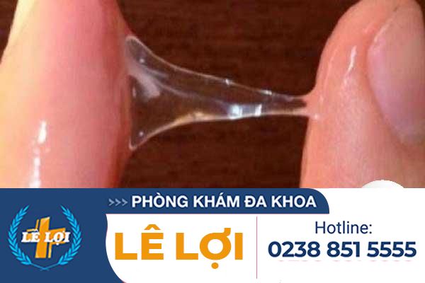 Huyết trắng bình thường có màu gì?