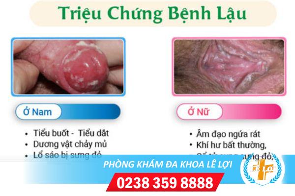 phong-kham-chua-benh-lau-uy-tin-tai-vinh-nghe-an-1