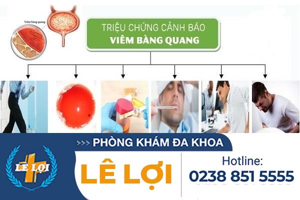 Bệnh viên bàn quan và những kiến thức cần biết