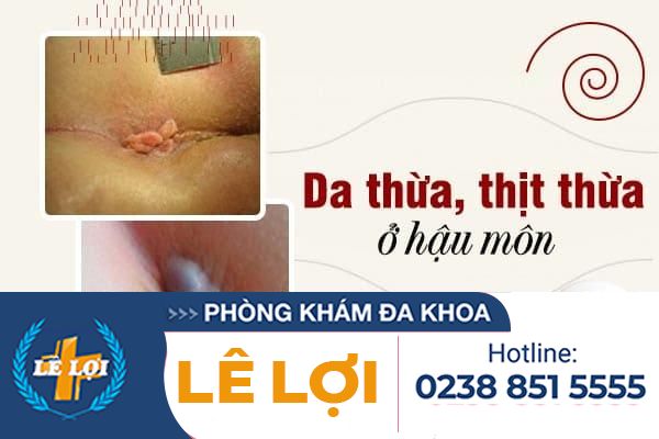 da-thua-thit-thua-o-hau-mon-la-benh-gi-1