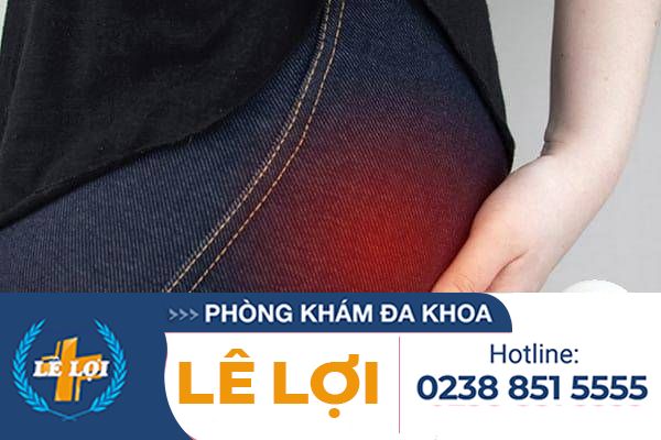 Da thừa, thịt thừa ở hậu môn là bệnh gì?