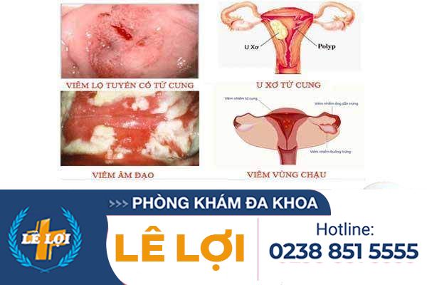 khi-hu-co-mui-benh-gi