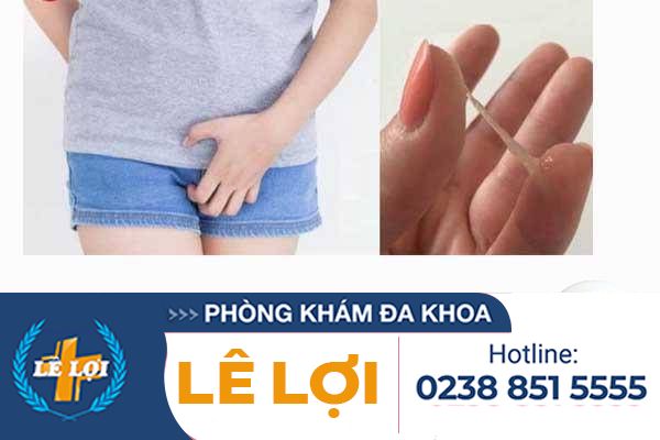 Khí hư ngứa là bệnh gì có nguy hiểm không?