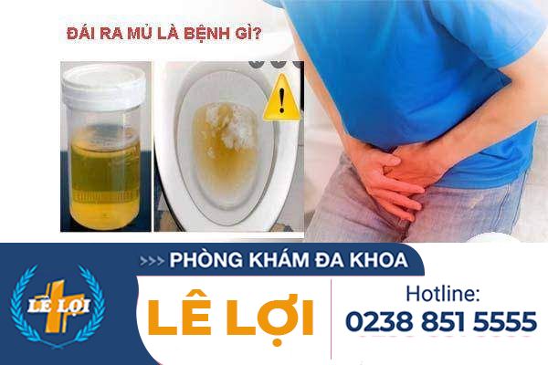 Đái ra mủ là dấu hiệu bệnh gì điều trị thế nào?