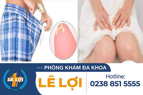 Cách điều trị đường tiết niệu có mủ hiệu quả