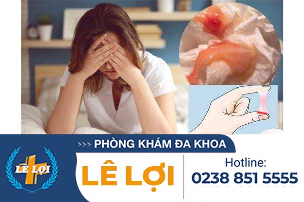 Huyết trắng màu hồng là bị bệnh gì?