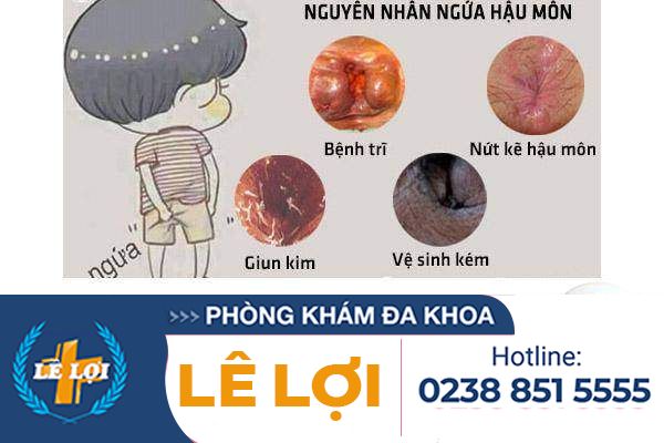 Nguyên nhân gây ngứa đít và cách khắc phục