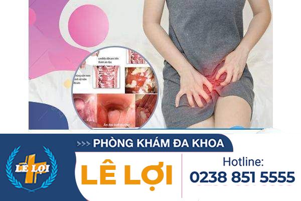 Ngứa 2 bên mép vùng kín là bị bệnh gì?