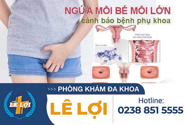 Ngứa môi bé môi lớn phải làm sao?