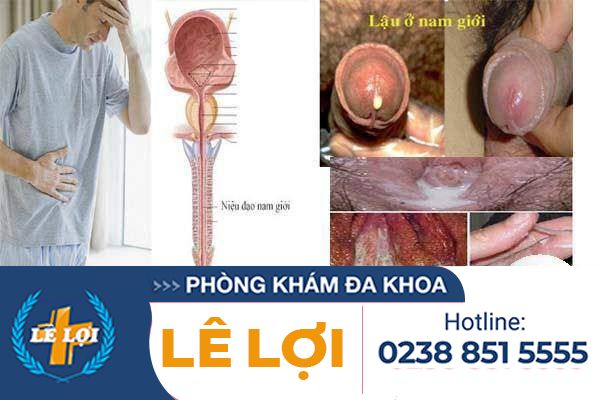 Niệu đạo chảy dịch là bệnh gì?
