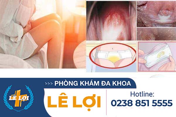 nieu-dao-chay-dich-nu