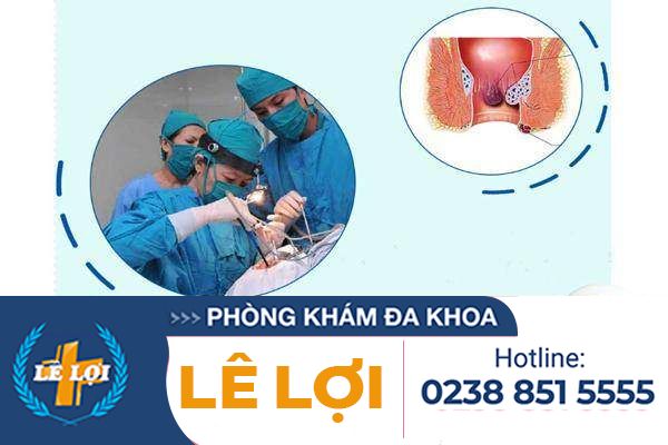 Phẫu thuật cắt trĩ thế nào chi phí ra sao?