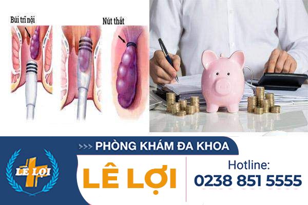 Giá 1 ca thắt búi trĩ bao nhiêu tiền?