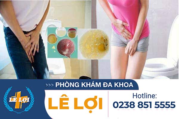 Tiểu ra mủ trắng phải làm sao?