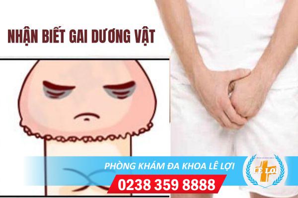 Dấu hiệu gai dương vật và cách điều trị