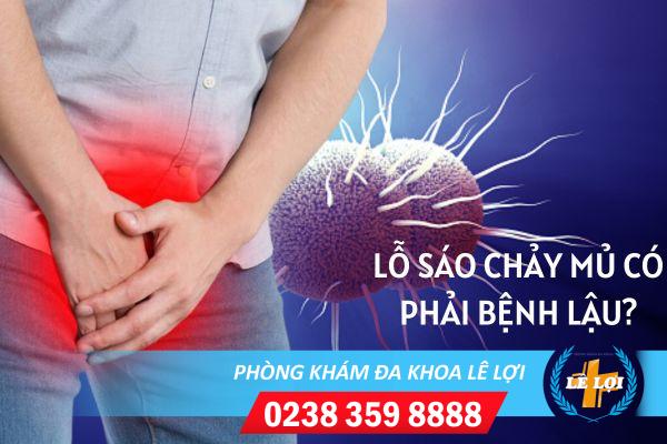 Lỗ sáo chảy mủ – dấu hiệu của bệnh gì?