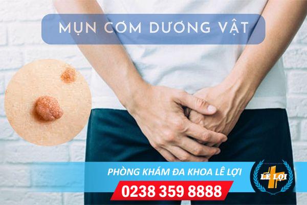 Dấu hiệu nổi mụn cơm dương vật cách điều trị