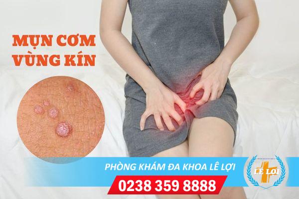 Nguyên nhân nổi mụn cơm vùng kín và cách điều trị