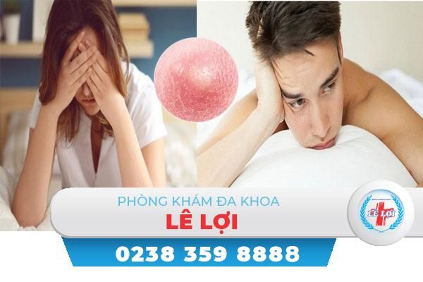 Mụn nhọt ở bẹn điều trị thế nào?