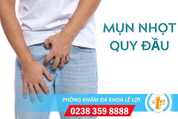 Nguyên nhân nổi mụn nhọt quy đầu và cách điều trị