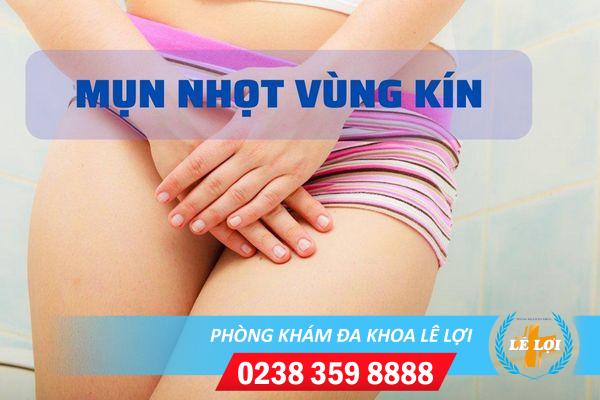 Mụn nhọt vùng kín là mắc bệnh gì?