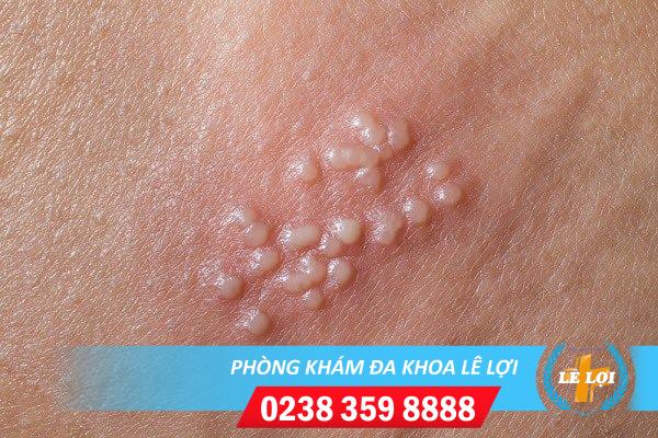 mun-nuoc-duong-vat-1
