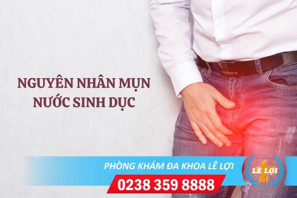 Những điều cần biết về mụn nước sinh dục