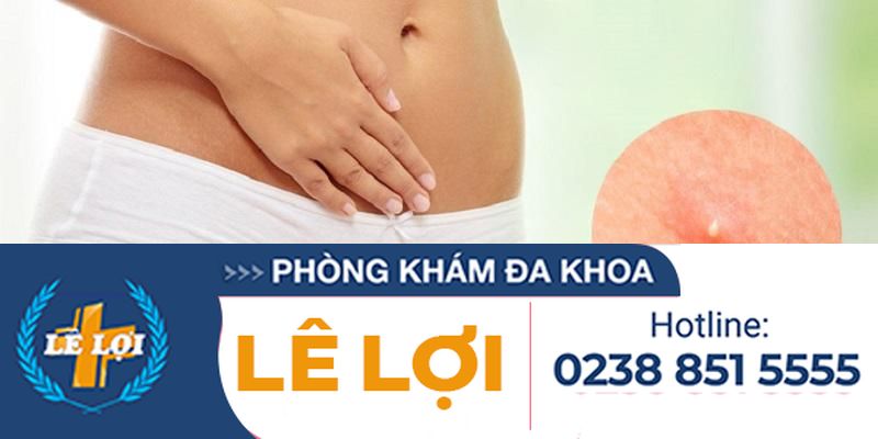 Cách điều trị nổi mụn trắng âm hộ hiệu quả