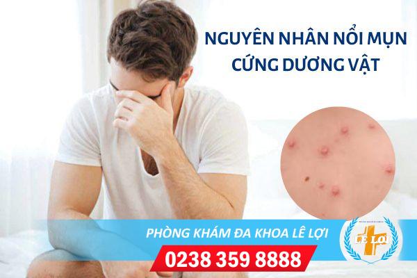 Nổi mụn cứng dương vật là bệnh gì?